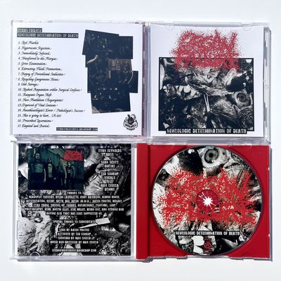 Organ Failure - "Neurologic Determination of Death" CD