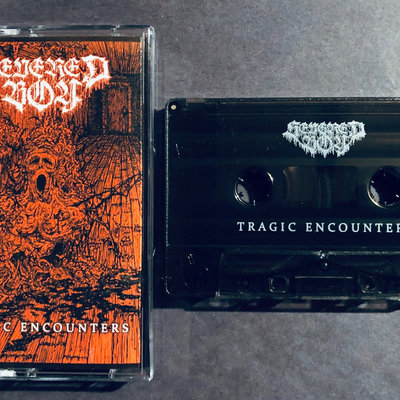 Severed boy - tragic encounters (cal-187) - Thumbnail 3