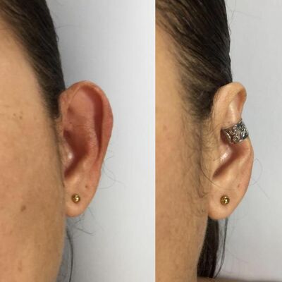 Accessory to beautify large ears