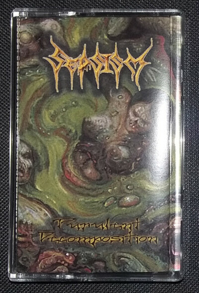 Sepsism "Purulent Decomposition" Tape