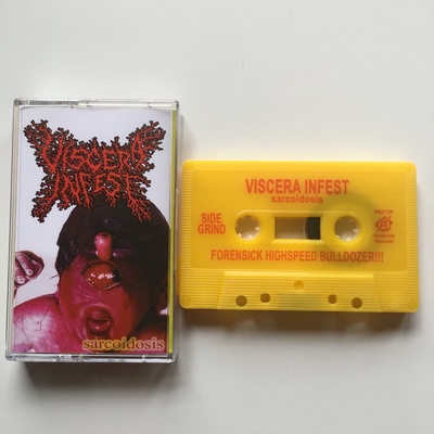 Viscera Infest - "Sarcoidosis"