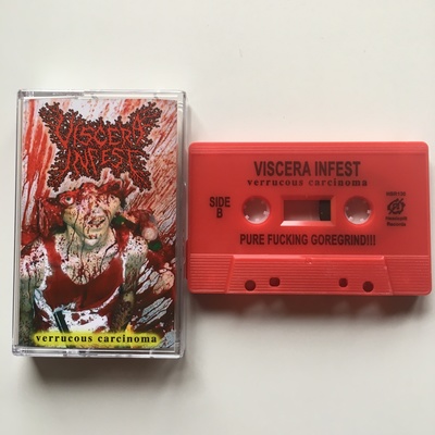 Viscera Infest - "Verrucous Carcinoma"