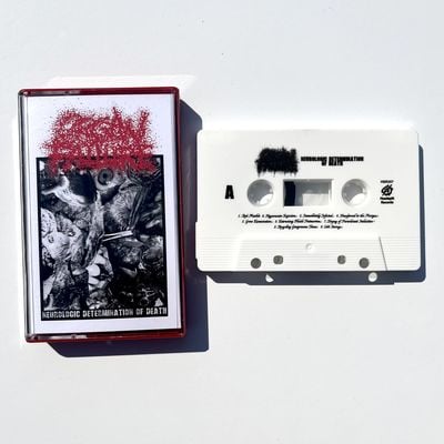 Organ failure - "neurologic determination of death" cassette