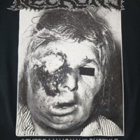 NECRONY "Severe Malignant Pustule" Long sleeve  - Thumbnail 3