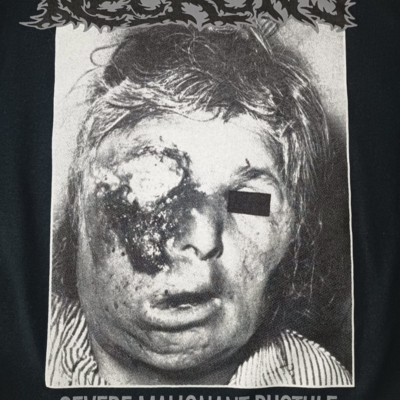 Necrony "severe malignant pustule" long sleeve 