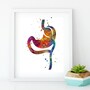 Gastric Bypass surgery watercolor art print-3