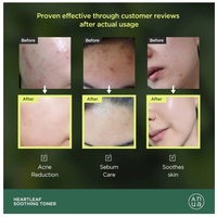 ANUA HEARTLEAF 77% SOOTHING TONER - Thumbnail 2