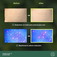 ANUA HEARTLEAF 77% TONER PAD - Thumbnail 2