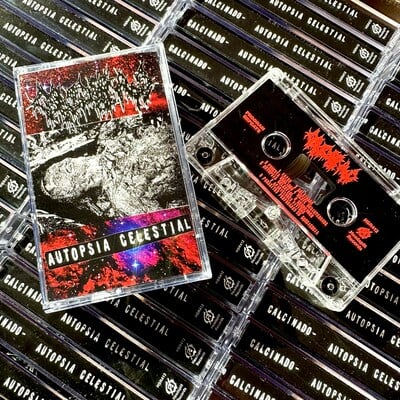 Calcinado - "autopsia celestial" cassette