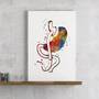 Gastric Bypass Watercolor Print-1