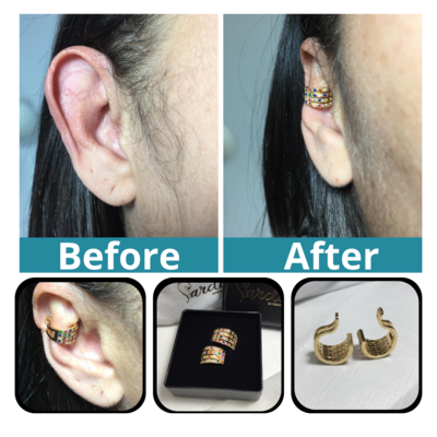 Accessory to beautify large ears