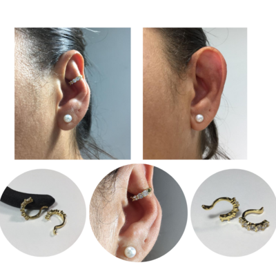 Accessory to beautify large ears