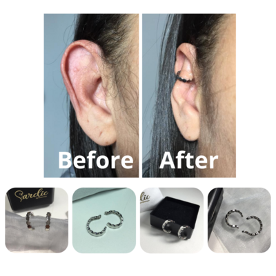 Accessory to beautify large ears