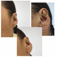 Accessory to beautify large ears - Thumbnail 2