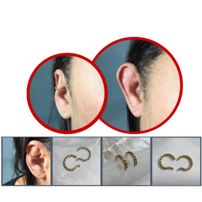Accessory to beautify large ears