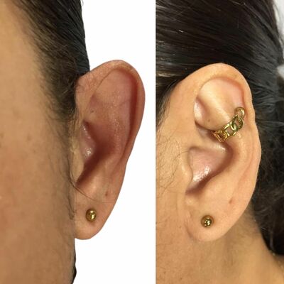 Accessory to beautify large ears