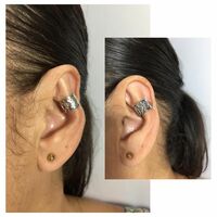 Accessory to beautify large ears - Thumbnail 1