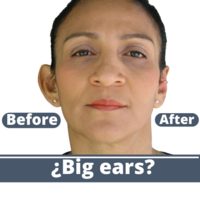 Accessory to beautify large ears - Thumbnail 9