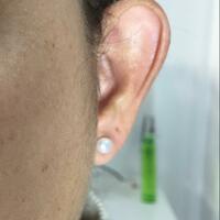 Accessory to beautify large ears - Thumbnail 2