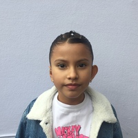 Accessory to beautify large ears - Thumbnail 3