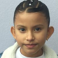 Accessory to beautify large ears - Thumbnail 6