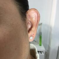 Accessory to beautify large ears - Thumbnail 8