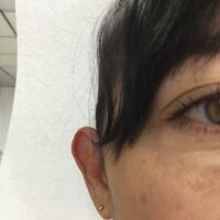 Accessory to beautify large ears - Thumbnail 9