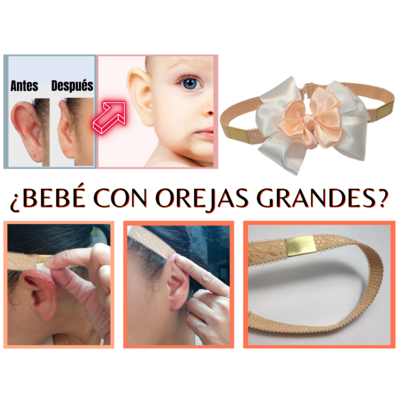Diadema para corregir las orejas grandes del bebé