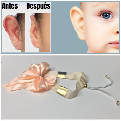 Diadema para enderezar las orejas de los bebés