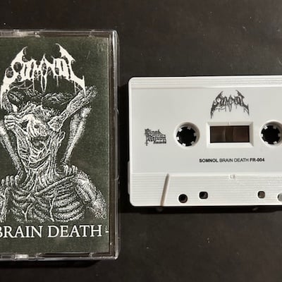 Somnol - brain death - Thumbnail 4