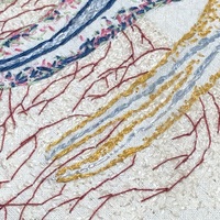 Wisdom Teeth - Thumbnail 3