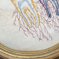 Wisdom Teeth - Thumbnail 5