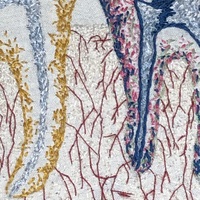 Wisdom Teeth - Thumbnail 6