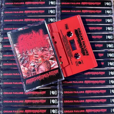 Organ Failure - "Assisted Anatomical Butchery" cassette