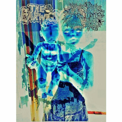 Tape: the earwigs/speculum "split"