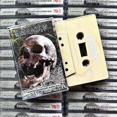 Estenosis - “desenterramiento sepulcral“ cassette