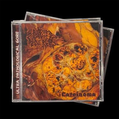 Blasted pancreas ‎– carcinoma (cd)