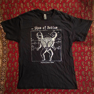 T-shirt - siamese baby autopsy