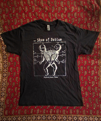 T-Shirt - Siamese baby autopsy