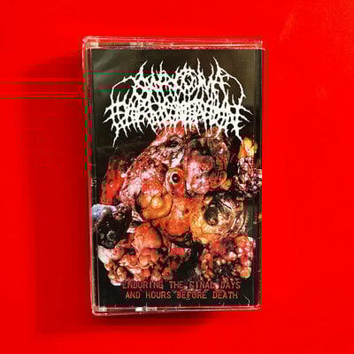 Sarcoma fermentation - enduring the final days and hours before death discography cs
