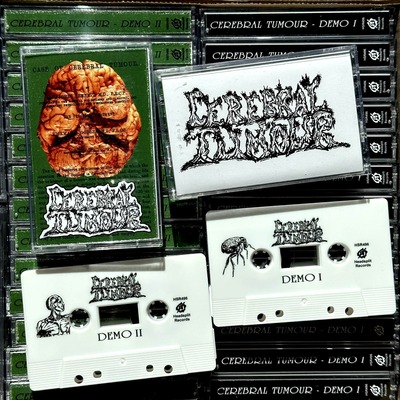 Cerebral tumour - demo 1 + demo 2 cassette