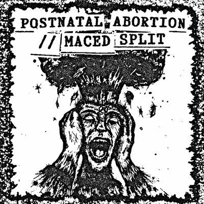 Postnatal Abortion/ Maced - Split Cassette