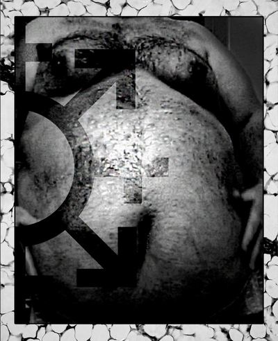 Swollen Organs 'Obesity Indoctrination' C-31