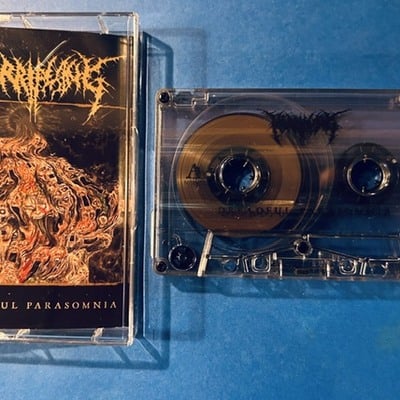 Horrifying - dreadful parasomnia 