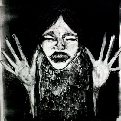 Repeatedly struck in the face