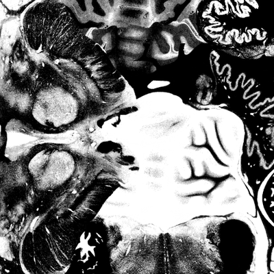 Regosphere / the vomit arsonist - split 7"