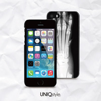 Stylish X-ray phone case for iPhone 7/6/6s , Samsung S8/S7/S6/Note5, Sony Z5 compact, LG Nexus, Nokia Lumia, HTC One M9/M8, Moto X, Moto E - A13 - Thumbnail 1