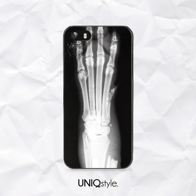 Stylish x-ray phone case for iphone 7/6/6s , samsung s8/s7/s6/note5, sony z5 compact, lg nexus, nokia lumia, htc one m9/m8, moto x, moto e - a13 - Thumbnail 3