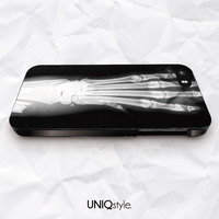 Stylish X-ray phone case for iPhone 7/6/6s , Samsung S8/S7/S6/Note5, Sony Z5 compact, LG Nexus, Nokia Lumia, HTC One M9/M8, Moto X, Moto E - A13 - Thumbnail 3