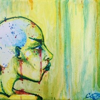 Trichotillomania - Thumbnail 1